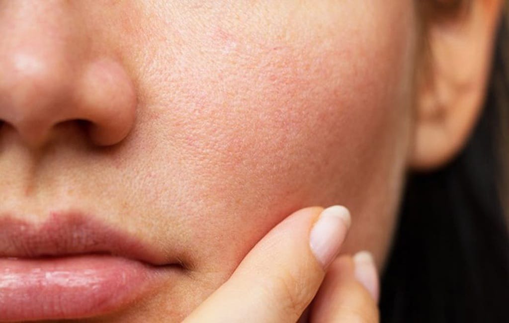 Những nguyên nhân khiến da bị bào mòn