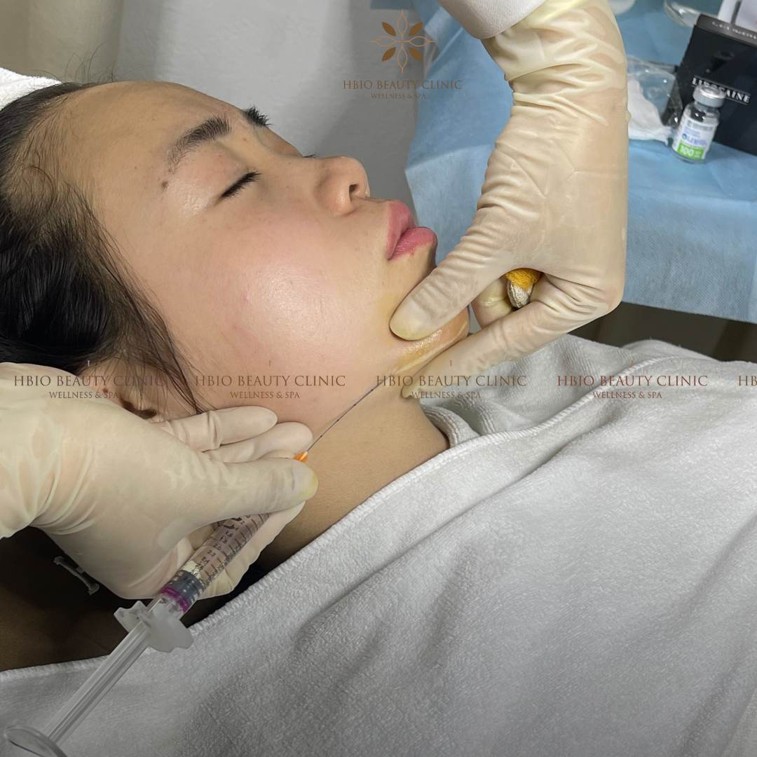 Nhược điểm của tiêm cằm tròn