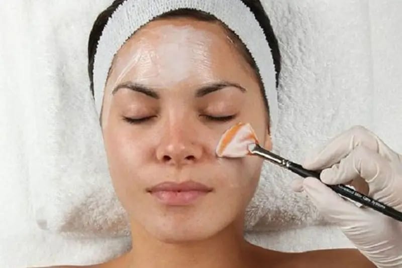 Peel da bao lâu thì tiêm Meso được?