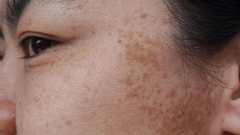 Tẩy tế bào chết đều đặn
