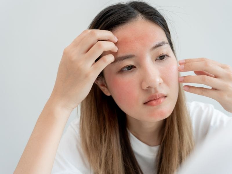 Thường xuyên nóng rát, châm chích, ngứa nhẹ