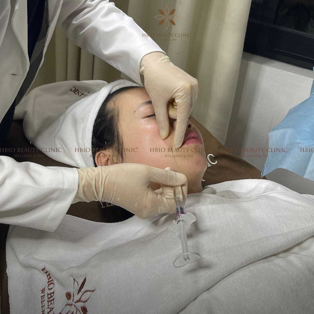 Tiêm hạ gò má có bị đơ không?