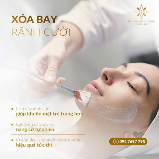 Tiêm rãnh cười bao nhiêu cc là đẹp?