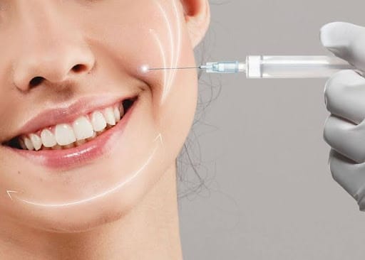 Tiêm rãnh cười là phương pháp làm đẹp an toàn