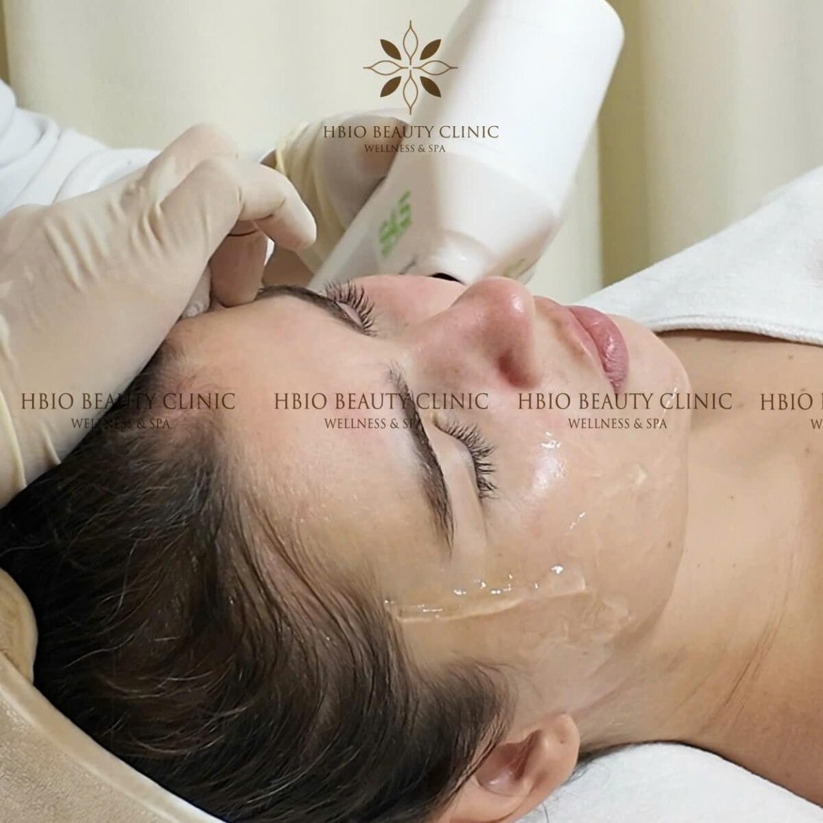 Trẻ hoá làn da nhờ công nghệ tiên tiến HIFU tại HBIO Clinic