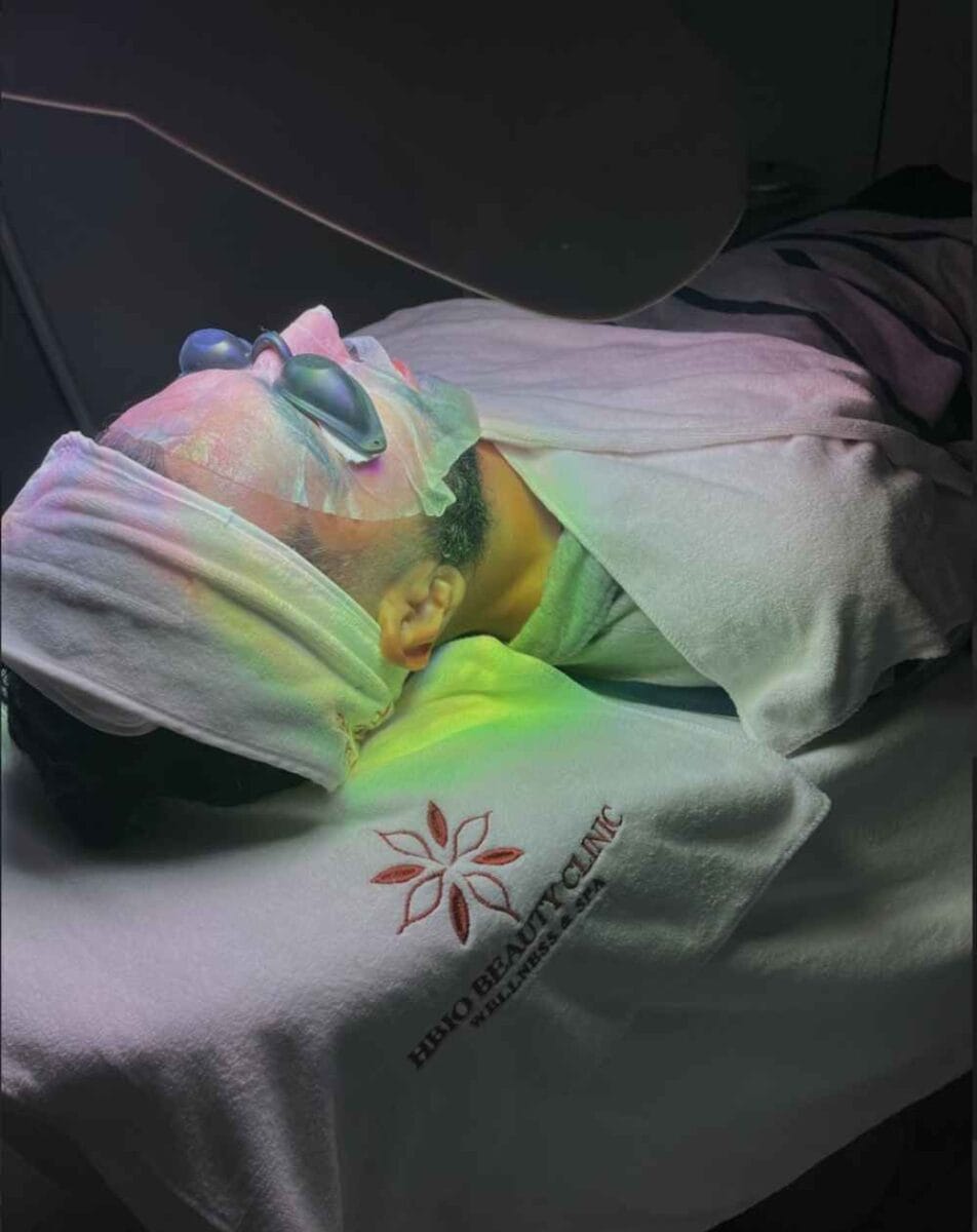 Trị mụn bằng ánh sáng xanh ít xâm lấn