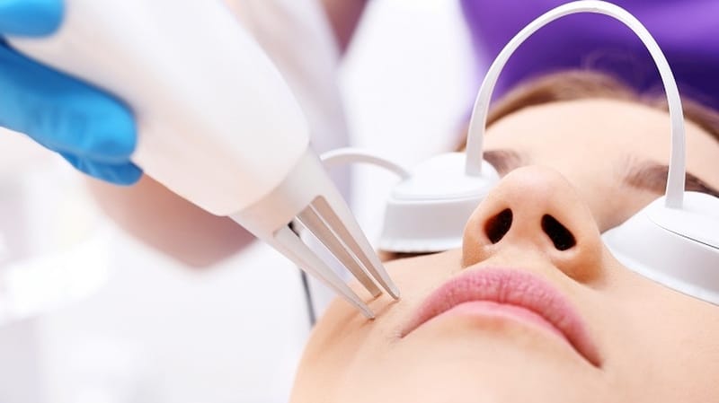 Trị sẹo rỗ có đau không?