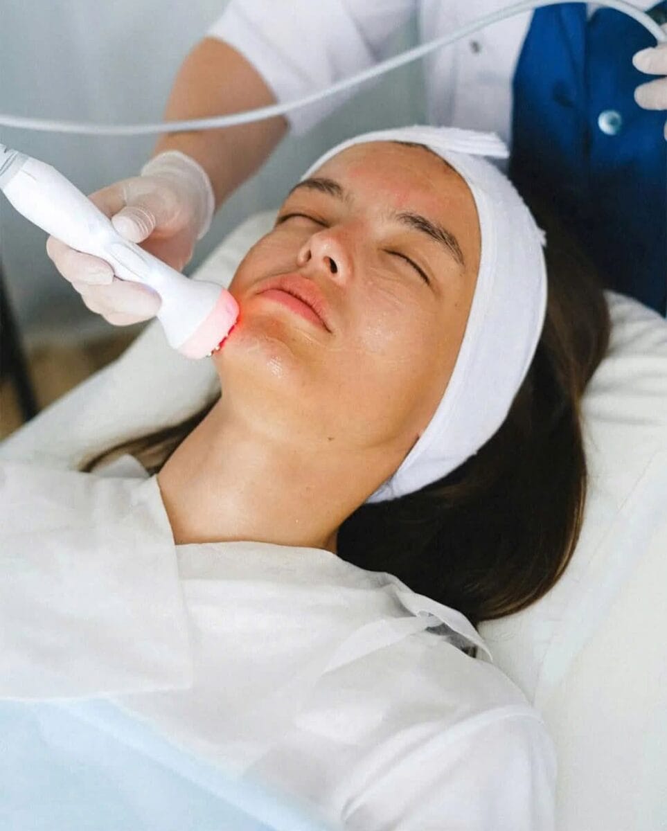 Triệt lông mặt cần cấp dưỡng ẩm đầy đủ