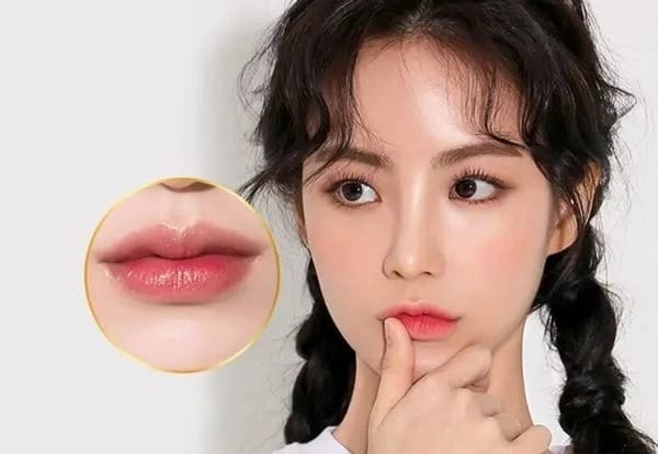 Advantages of cherry lip injection at HBIO Clinic