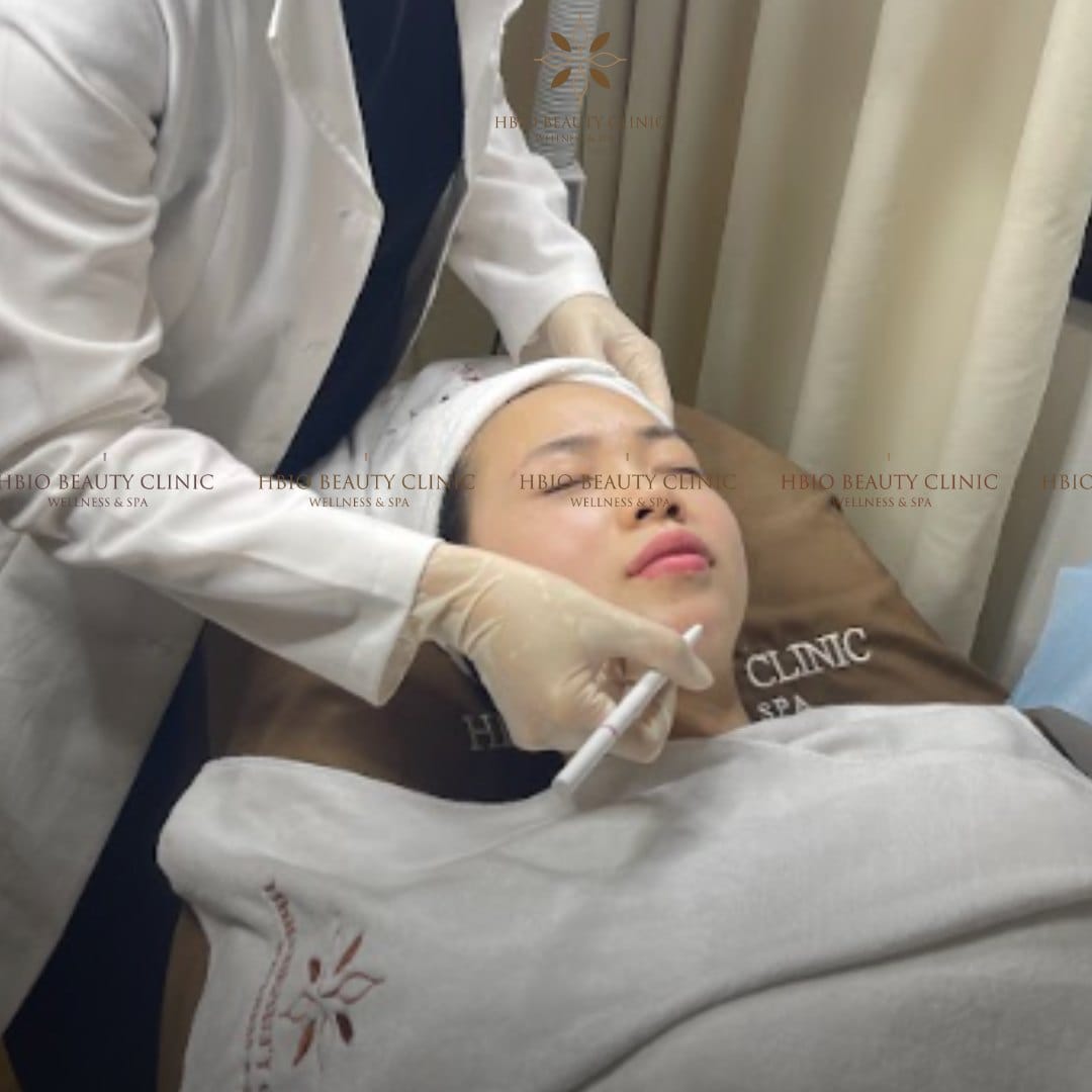 Ưu nhược điểm của tiêm cằm tròn