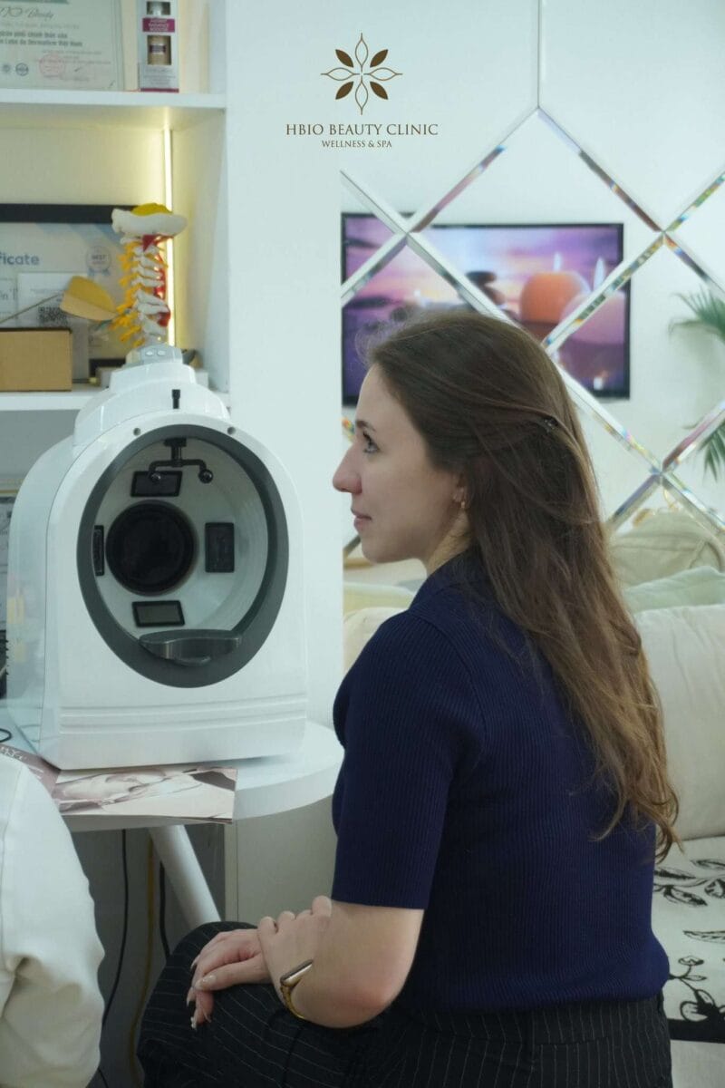 Căng chỉ mắt có đau không?