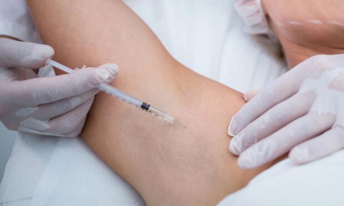 Chuẩn bị cẩn thận trước khi pha Botox tiêm nách