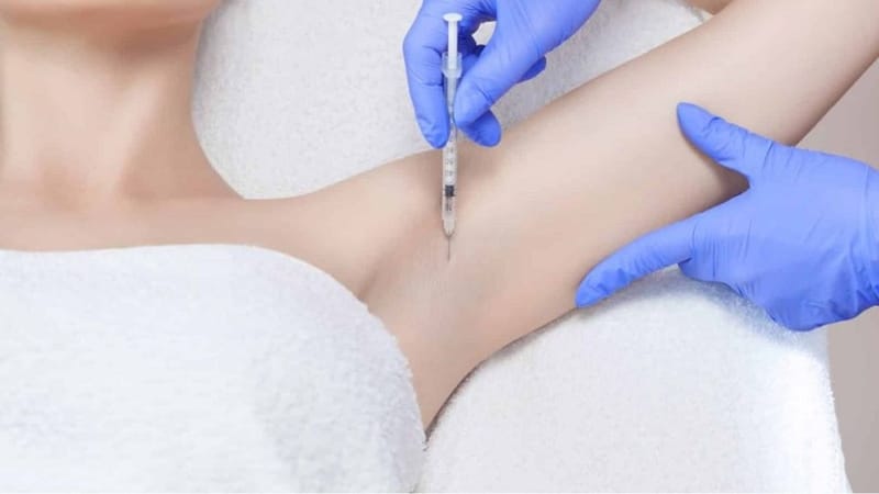 Địa chỉ tiêm Botox nách uy tín – Hbio Clinic