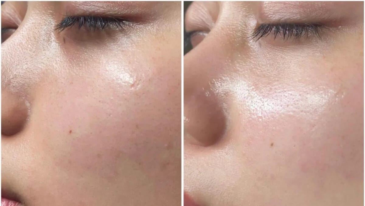 Hiệu quả nhanh chóng