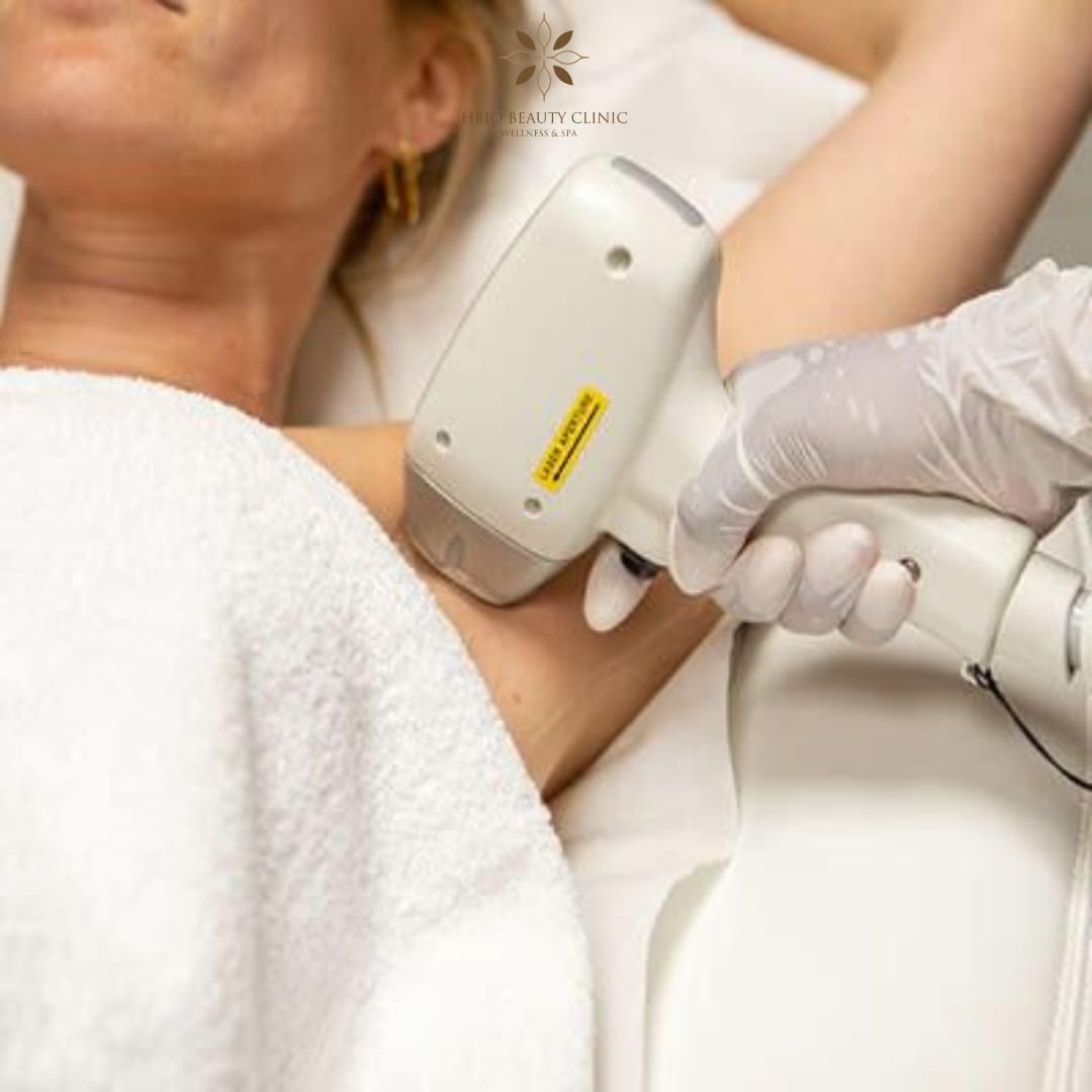 Triệt lông vĩnh viễn có mọc lại không 