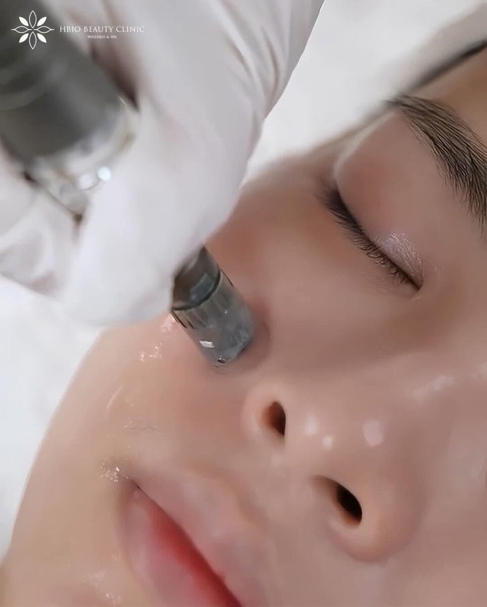 Các loại peel da sinh học phổ biến