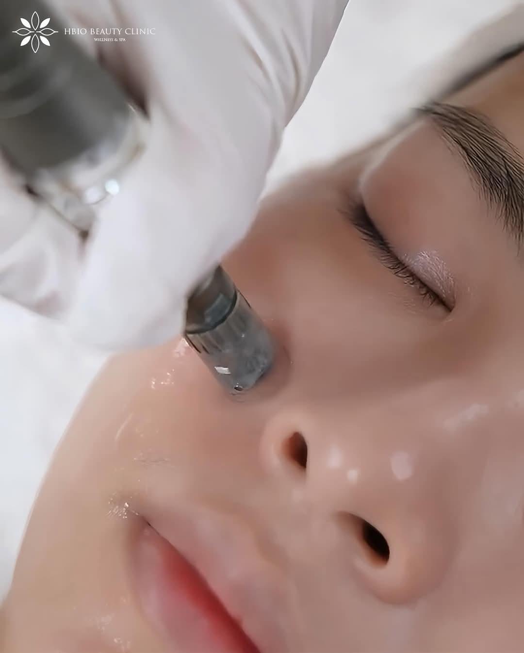 Thực hiện peel Glycolic Acid uy tín chuẩn y khoa tại HBIO Clinic