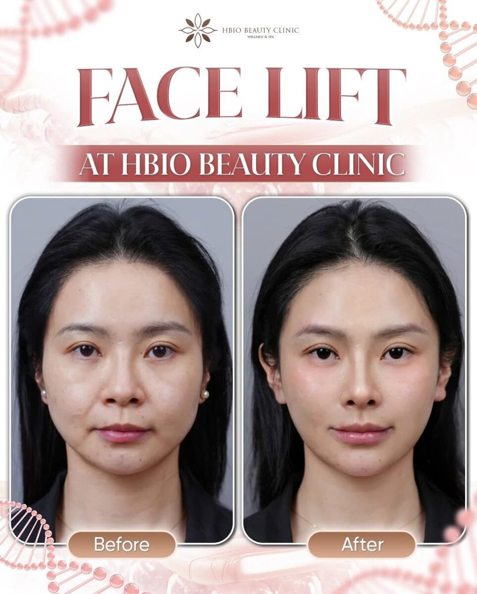 Facial cơ bản (Basic Facial) – làm sạch và thư giãn da