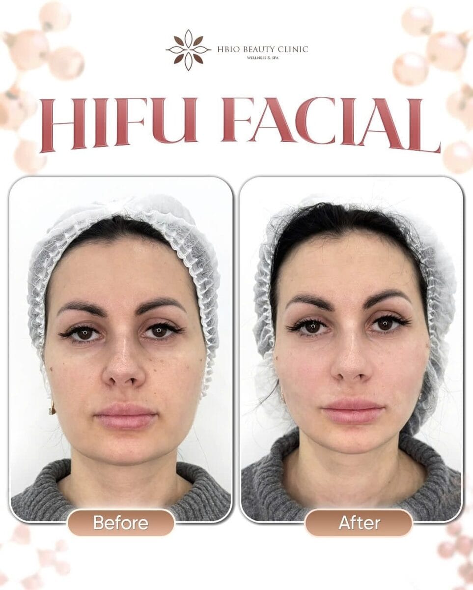 Hiệu quả cải thiện rõ rệt và duy trì lâu dài