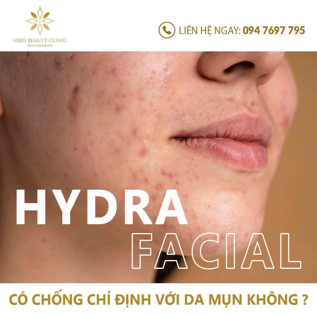 HydraFacial – làm sạch sâu + cấp ẩm đa tầng