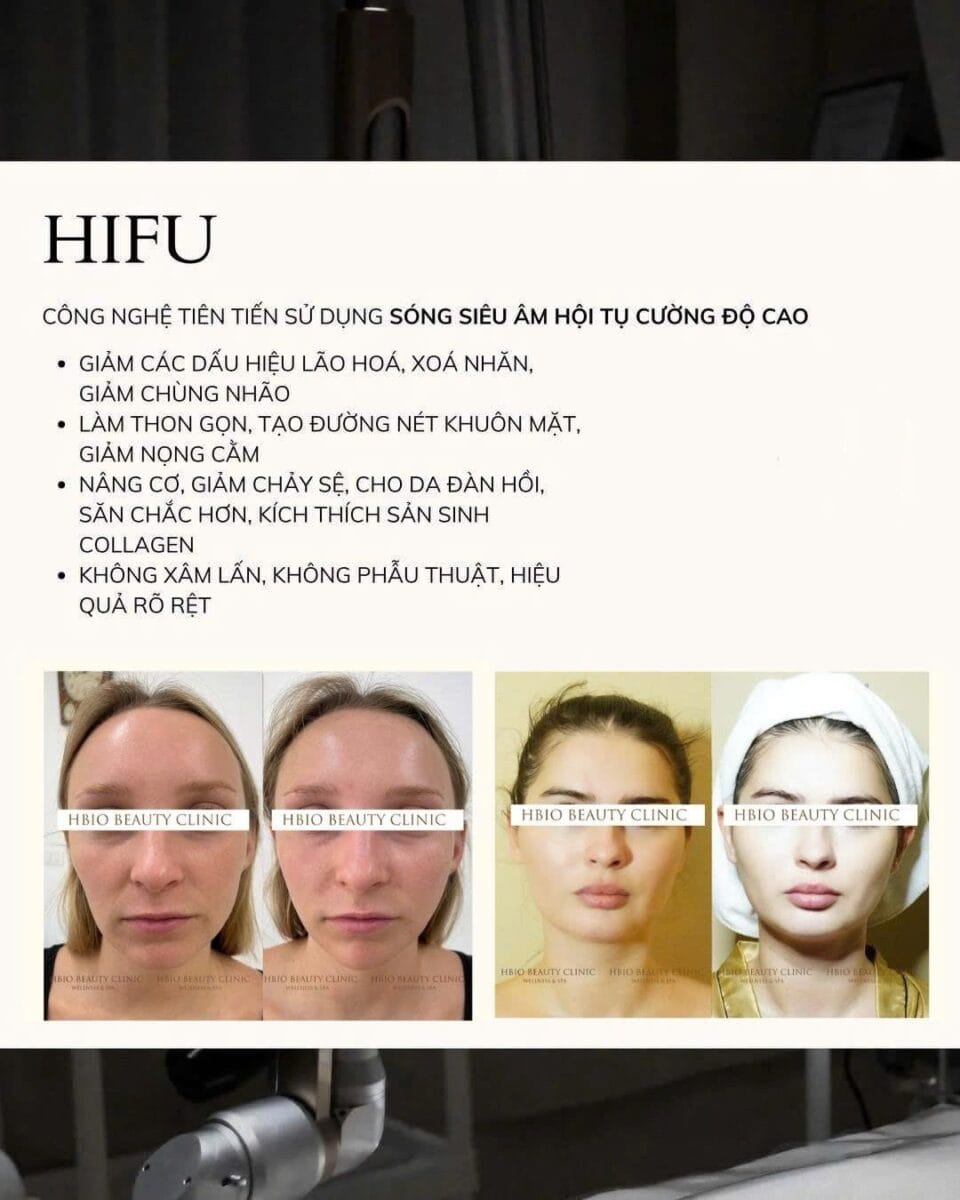 Khi nào chọn HIFU?