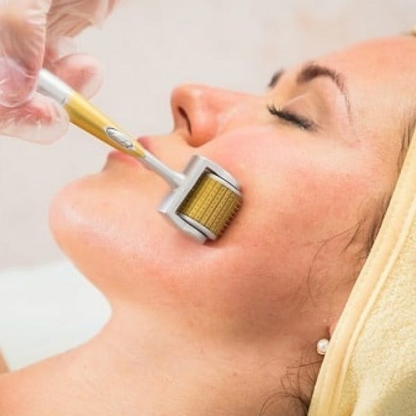 Lăn kim & vi kim – Kích thích tái tạo da