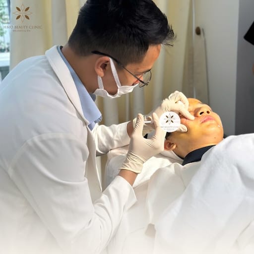 Liệu pháp PRP trị nám hỗn hợp