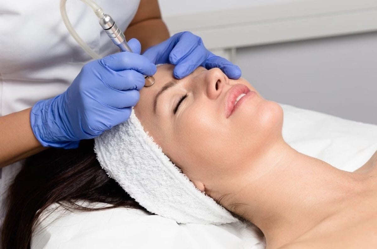Mài da vi điểm (Microdermabrasion)