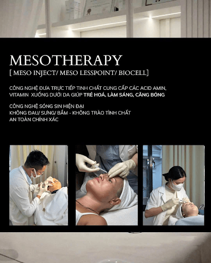 Mesotherapy – Cấy tế bào gốc trực tiếp vào da