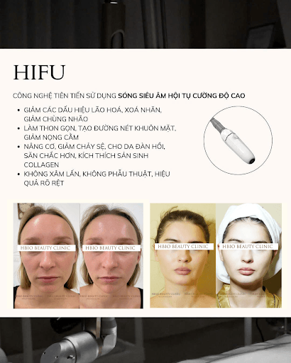 Tác dụng của công nghệ HIFU trong nâng cơ và trẻ hóa da