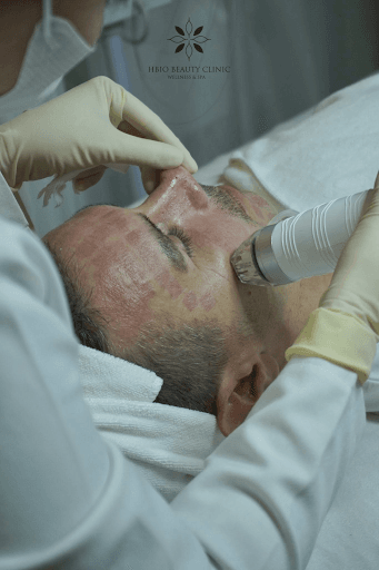 Tăng độ căng bóng và trẻ trung tự nhiên