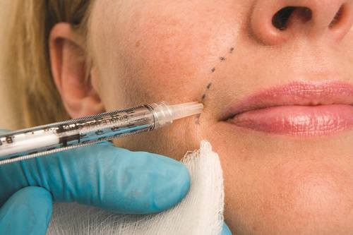 Botox® injections are a non-invasive cosmetic solution.