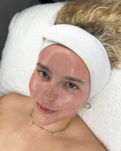 Trẻ hóa da bằng tế bào gốc là gì?