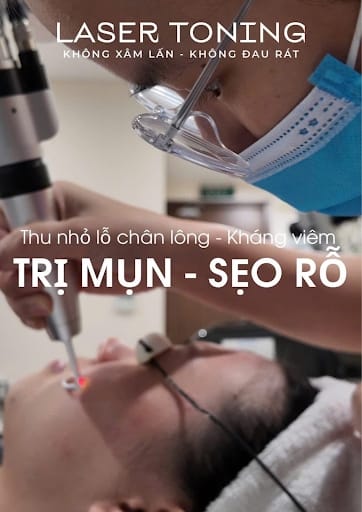 Trị nám hỗn hợp bằng công nghệ Laser