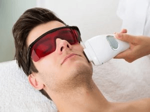 Vì sao cần triệt râu quai nón?