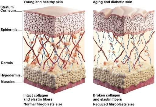 Biostimulator là một phương pháp thẩm mỹ hiện đại