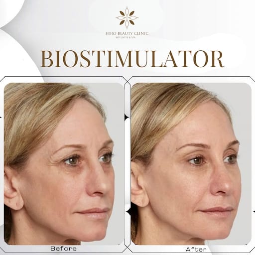 Chăm sóc và duy trì hiệu quả lâu dài