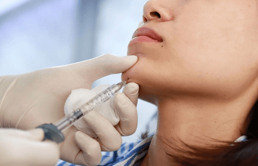 Có nên tiêm cằm chẻ không?