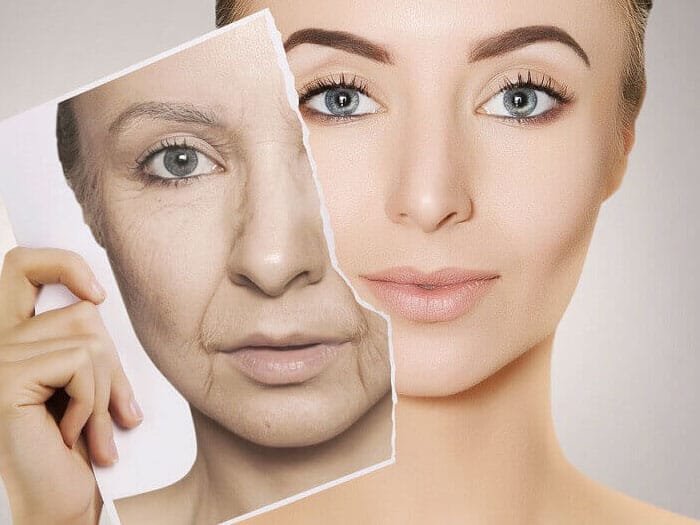 Đường viền hàm bị chảy xệ do lão hoá tự nhiên