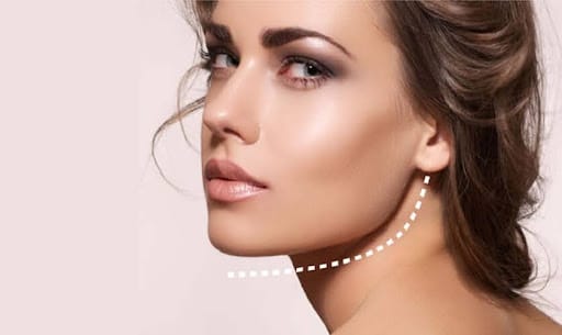 Nguyên nhân hình thành xương hàm chữ L