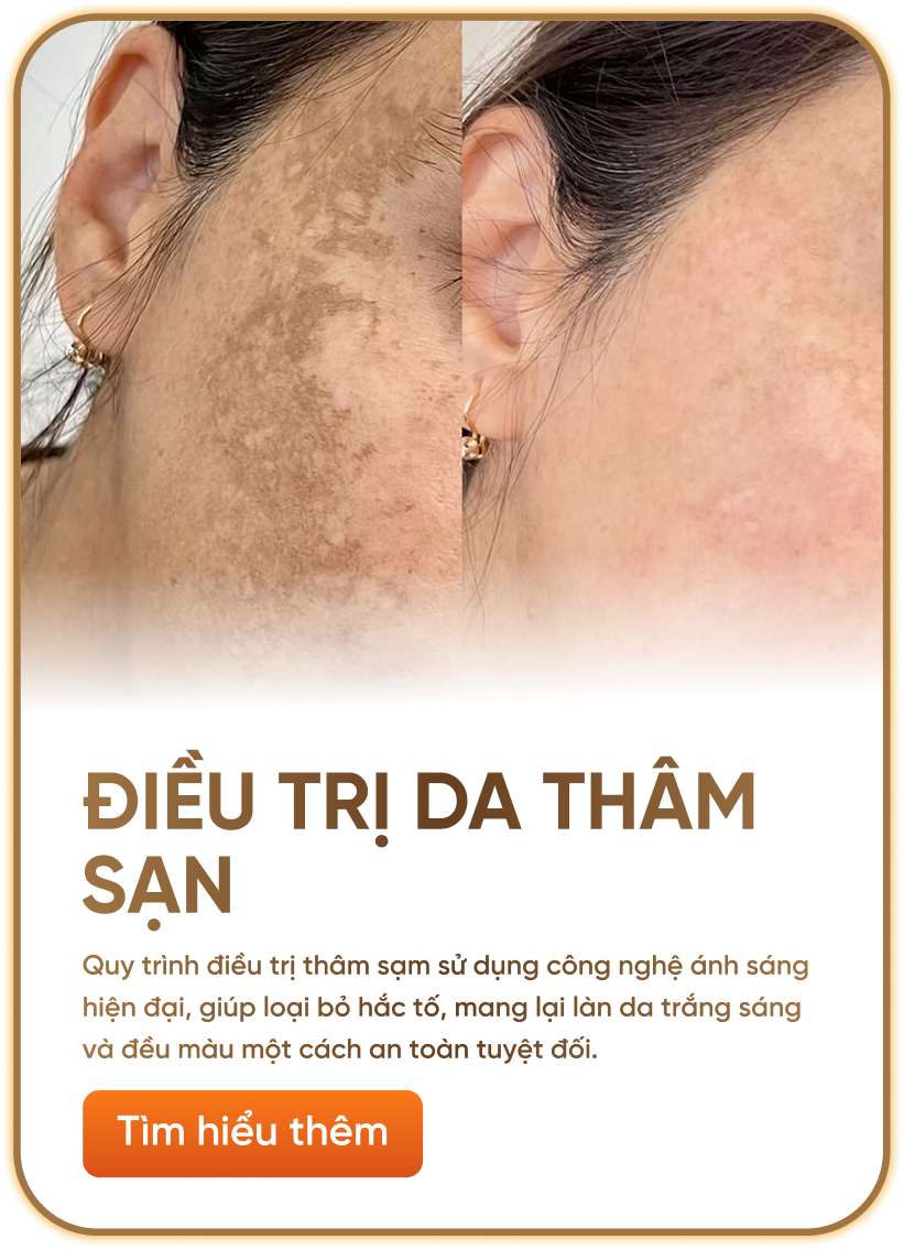 Điều trị da thâm sạn