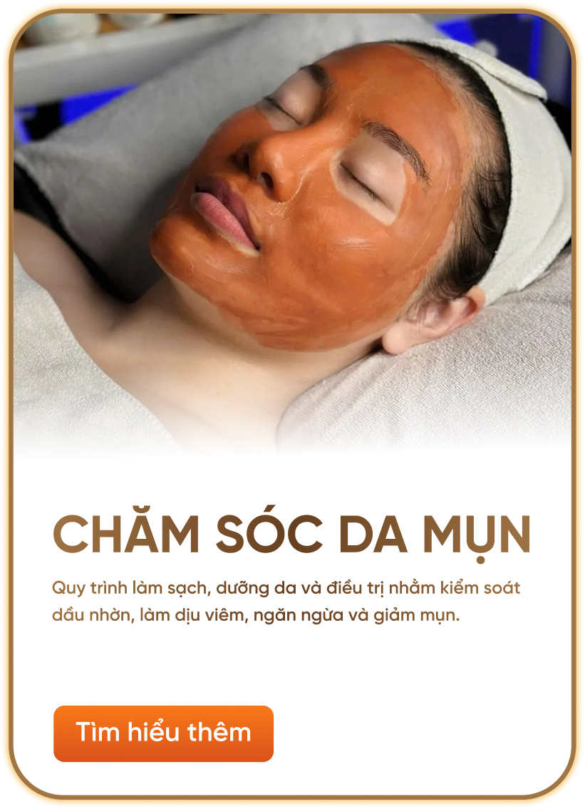 chăm sóc da mụn