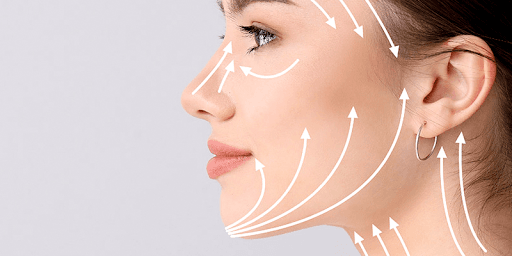 Chỉ PLLA có khả năng kích thích collagen mạnh mẽ