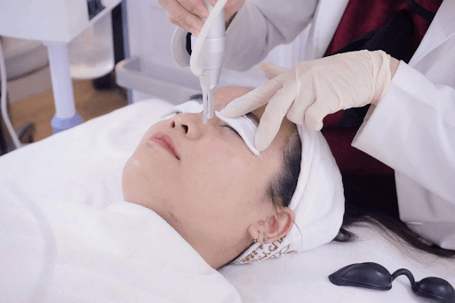 Laser CO2 Fractional: Công nghệ tái tạo da chuyên sâu hàng đầu