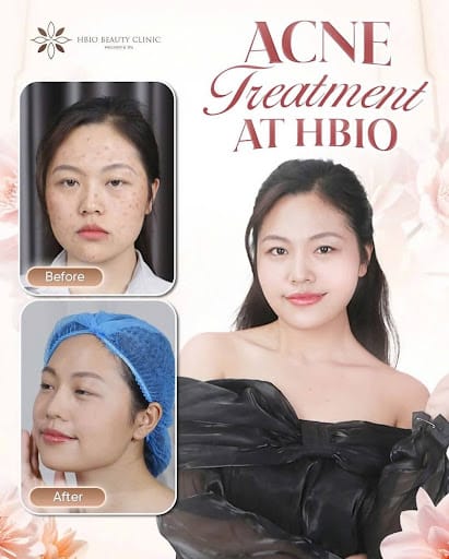 Những yếu tố ảnh hưởng đến hiệu quả vi kim tảo biển