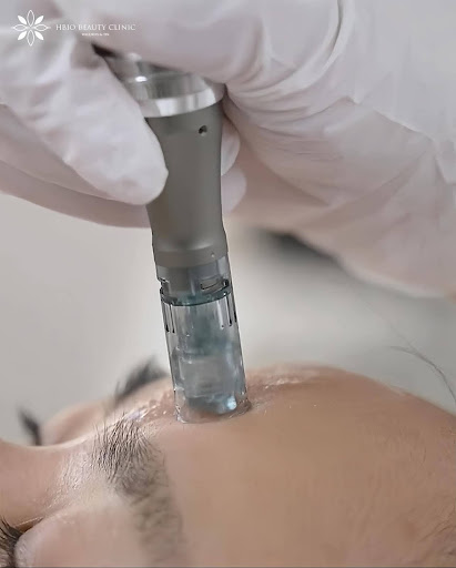 Phi kim là phương pháp thực hiện bởi máy móc