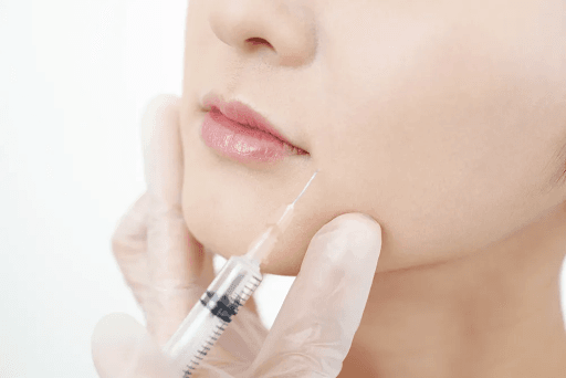 Tạo hình khuôn mặt tỷ lệ vàng bằng phương pháp filler