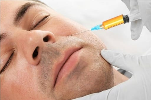 Thẩm mỹ giảm mỡ mặt tại HBIO Clinic