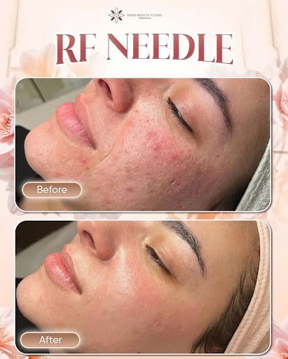 Vi kim tảo biển mấy lần thì da đẹp?