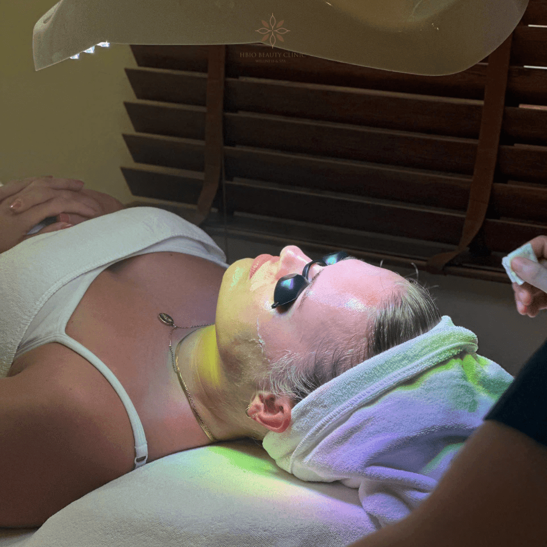 Điều trị mụn cóc tại HBIO Clinic